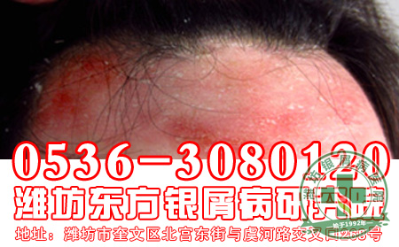 皮肤护理