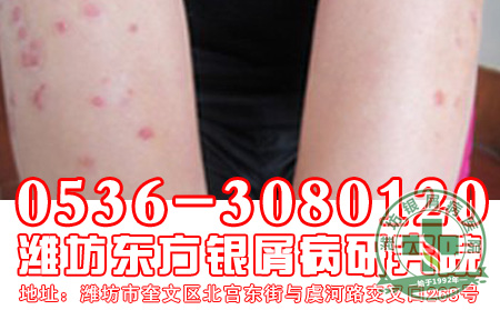 小部分银屑病患者为什么会放弃治疗?