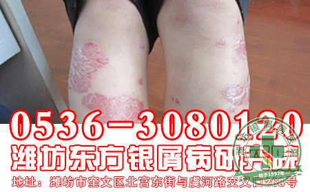 好皮肤，“泡出来”——“中药药浴”轻松治疗