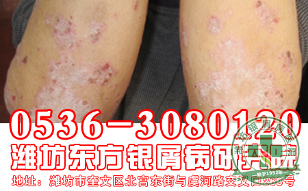 银屑病患者的饮食偏方—凉拌苦瓜