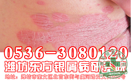 主任简述：老年银屑病患者护理要点