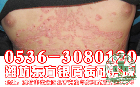 主任答疑：女性患者发病率越来越高是何原因