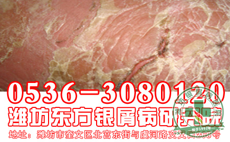 手部牛皮癣如何护理