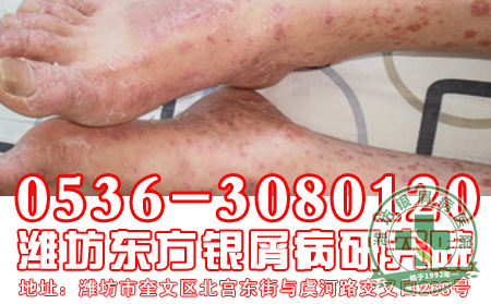 怎样用药才能减少药物给患者的伤害?