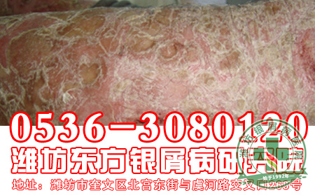 银屑病患者禁用哪些药物进行治疗?