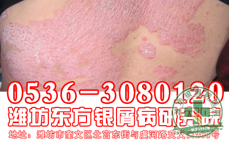哪些因素会对患者患者造成影响