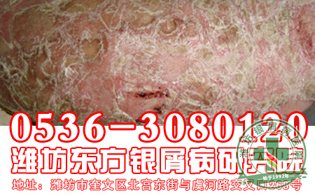 银屑病发病与精神因素有何关系？