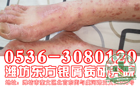 心理因素也会影响患者的病情吗?