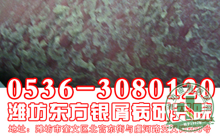 对于银屑病,患者应该怎样做好诊断工作?
