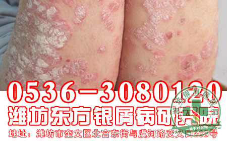 银屑病怎样护理有助于减少皮损加重？