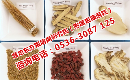 治疗牛皮癣可以使用偏方吗