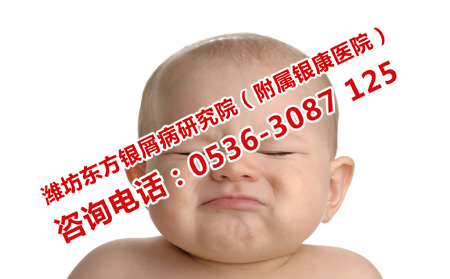 章丘哪里治孩子银屑病好